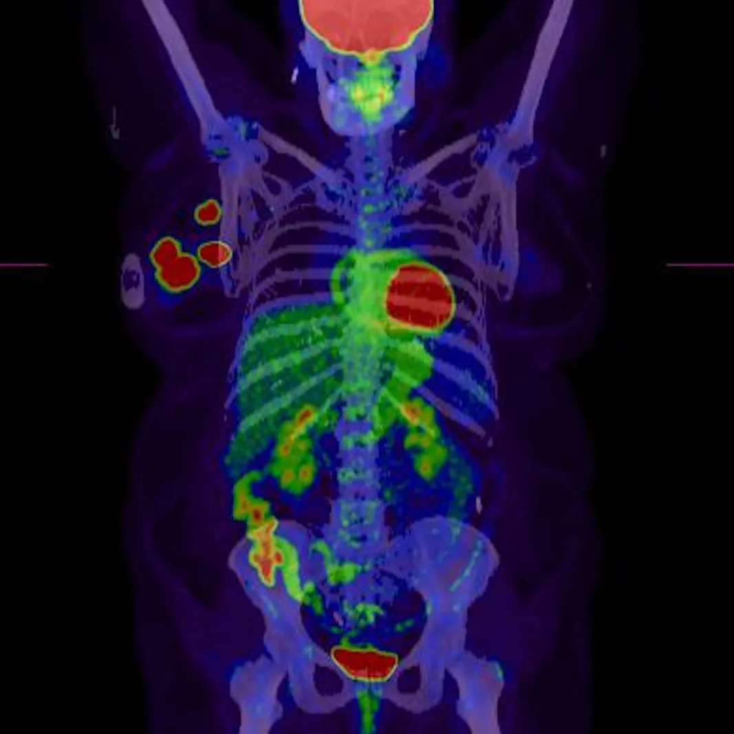 Example of molecular imaging