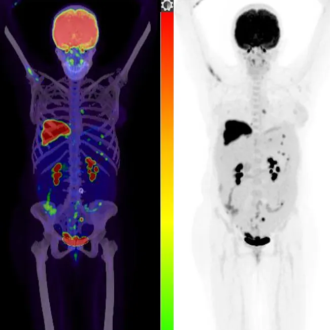 Body scans results